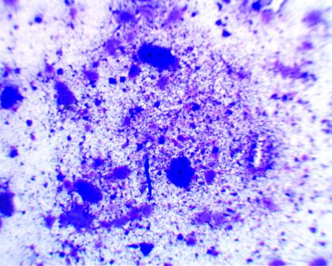 Bacillus subtilis. Courtesy Forensics Lab Supply